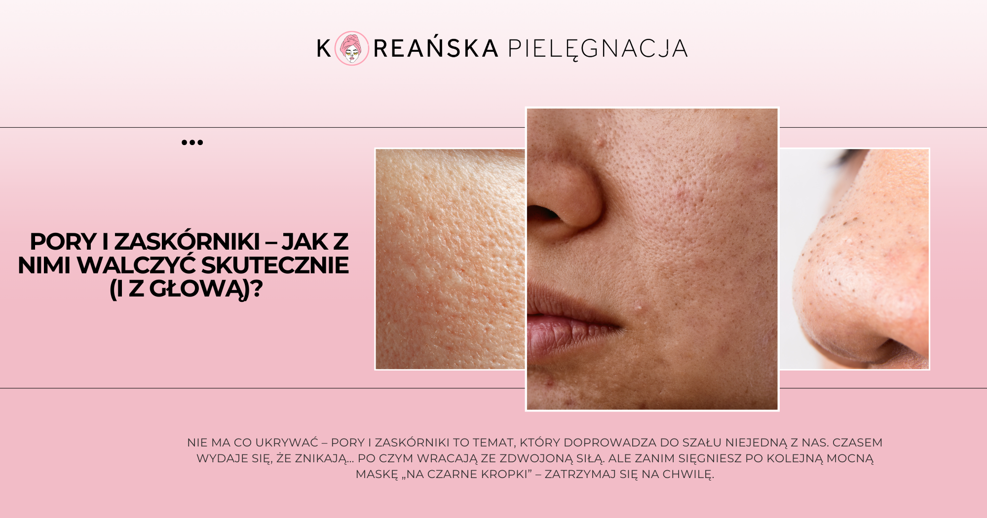 Pory i zaskórniki – jak z nimi walczyć skutecznie?